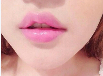 注射,丰唇,薄情命运,素颜,美女