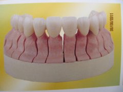 烤瓷牙有危害吗