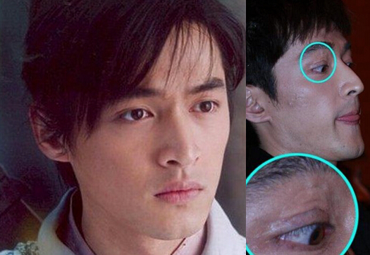 胡歌个人资料,胡歌整容前后对比