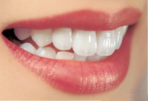 烤瓷牙,磁共振,检查