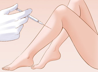 注射瘦腿