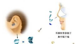 软骨隆鼻到底果好不好