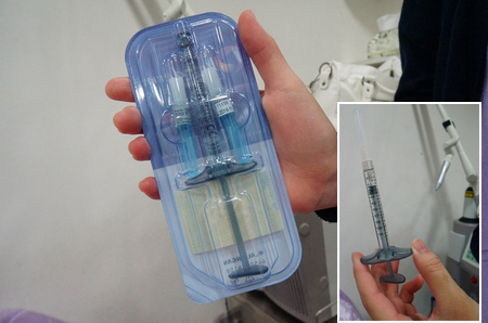 美女注射乔雅登玻尿酸去法令纹 前后对比图曝光