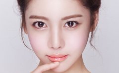 成都双眼皮手术要多少钱