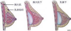 脂肪少可以做自体脂肪隆胸吗