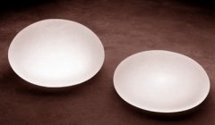 假体隆胸多久可以取出