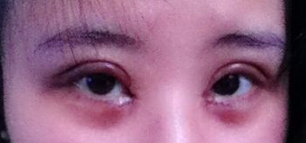 太原华美整形医院