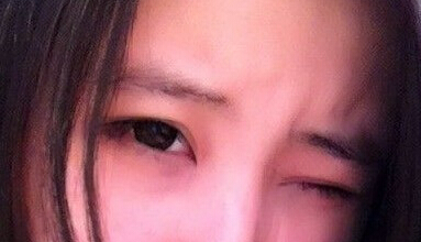 太原华美整形医院