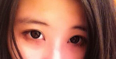 太原华美整形医院