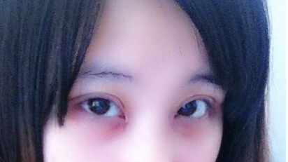 太原华美整形医院