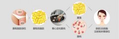自体脂肪填充能保持多久 自体脂肪填充能保持多久