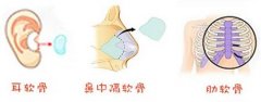 自体软骨隆鼻的材料有哪些 自体软骨隆鼻的材料有哪些