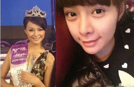 沈梦辰,个人,资料,整容,前后,对比