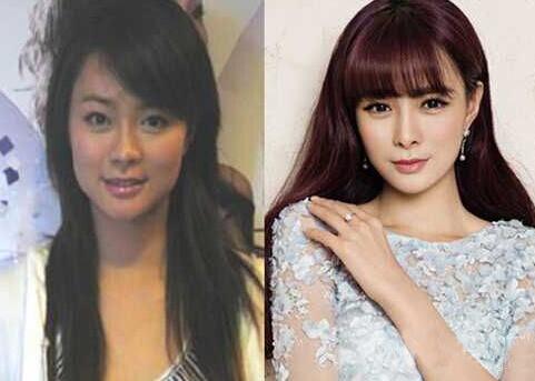 沈梦辰,个人,资料,整容,前后,对比