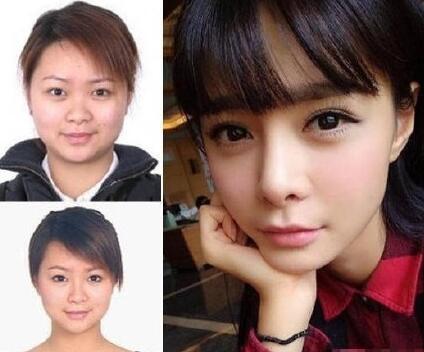 沈梦辰,个人,资料,整容,前后,对比