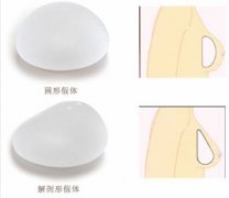 麦格假体丰胸类型 麦格假体丰胸类型