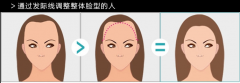发际线过高 发际线后移要多少钱