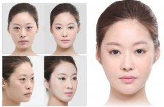 眼袋整形手术有哪些方法 眼袋整形手术有哪些方法