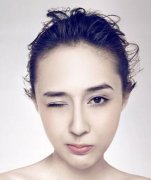 冬天适合做双眼皮吗