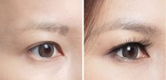 女性怀孕可以做眉毛种植吗 女性怀孕可以做眉毛种植吗