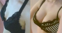 假体隆胸影响母乳吗