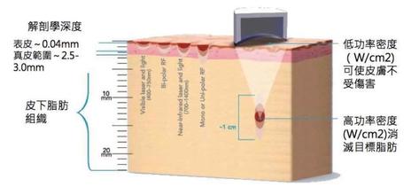 热立塑、超声减脂和冷冻溶脂减肥三者之间有什么区别