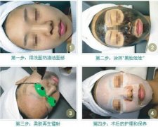 做黑脸娃娃果怎么样