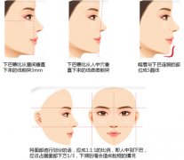 玻尿酸垫下巴果如何 小分子玻尿酸能垫下巴吗 玻尿酸垫下巴果如何 小分子玻尿酸能垫下巴吗