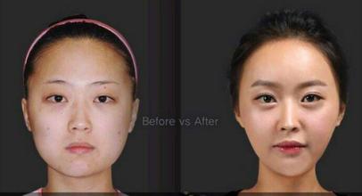 全新眉毛美容整形图片