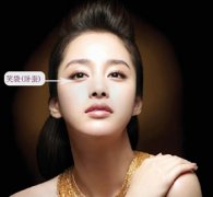 去眼袋手术会影响卧蚕吗 去眼袋手术会影响卧蚕吗