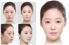 去眼袋手术会影响视力吗 去眼袋手术会影响视力吗