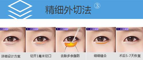 微创去眼袋果怎么样