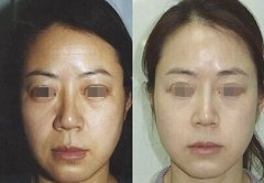 电波l皮能维持多久