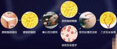自体脂肪移植丰胸成活率高不高