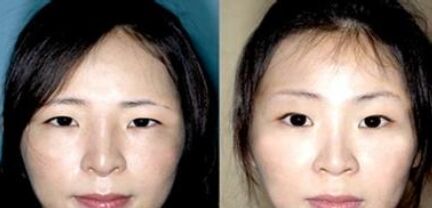 眉毛上提图片