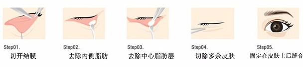 眼袋形成的原因有哪些 用喜欢的方法消除眼袋