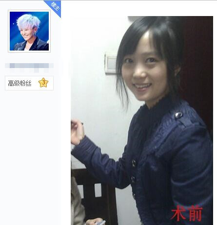 韩式微创去眼袋成好吗