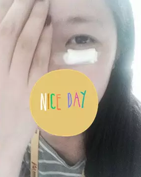 什么是微创去眼袋