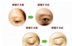 种植眉毛果图片 种植眉毛果图片