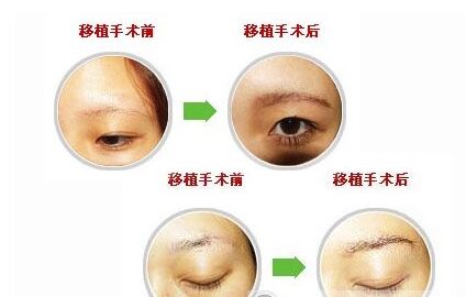 种植眉毛果图片