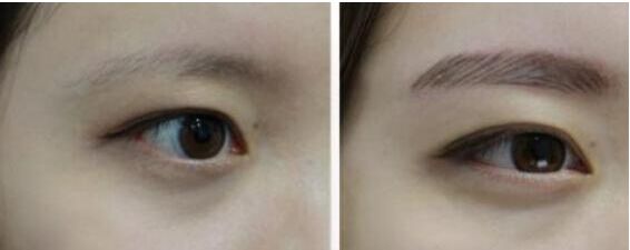 种植眉毛果图片