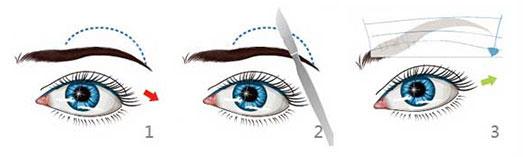 切眉手术前后对比照片