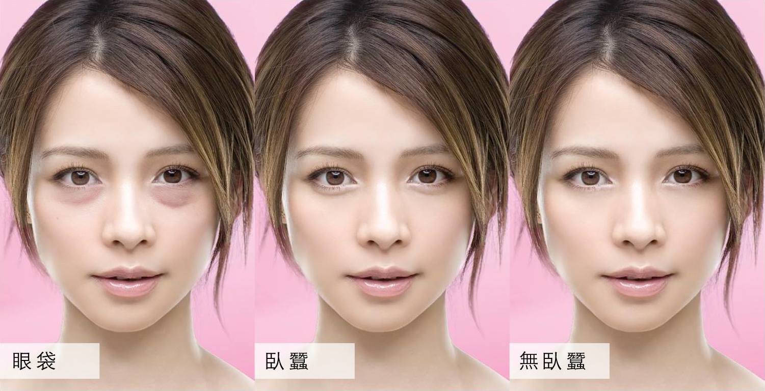有了眼袋该怎么办