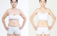 吸脂减肥对身体有什么危害吗