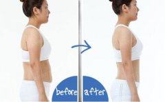 全身吸脂减肥费用多少