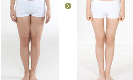 做完吸脂,卧床休息