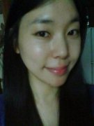 酒窝成形手术果对比图