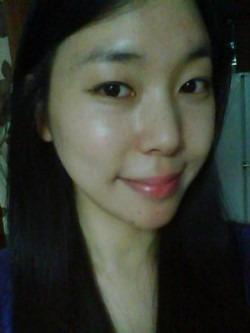 酒窝成形手术果对比图