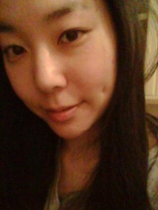 酒窝成形手术果对比图