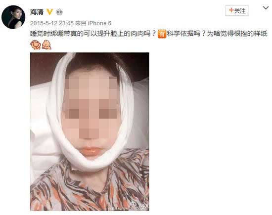 海清,绷带,hold住颜值,提升面部,要这么麻烦吗